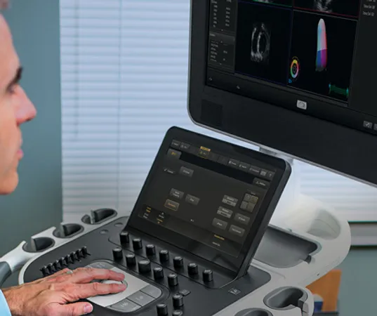 foto de ultrasonido